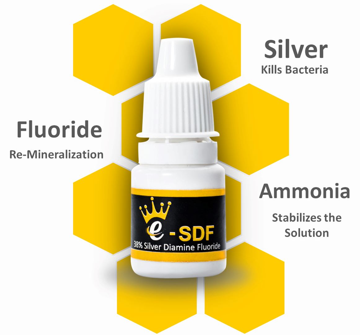 e- SDF (Silver Diamine Fluoride)